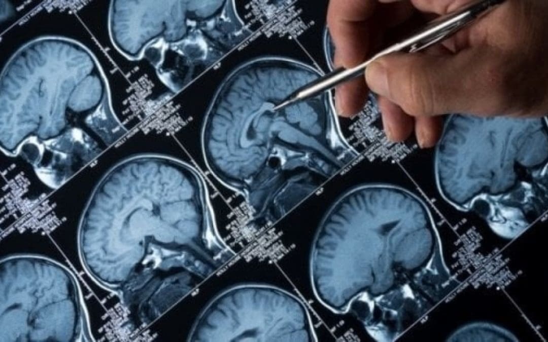 L’utilizzo della tecnologia ha comportato risultati positivi in diverse sperimentazioni condotte su animali. Nel 2019 è in programma un test sugli esseri umani