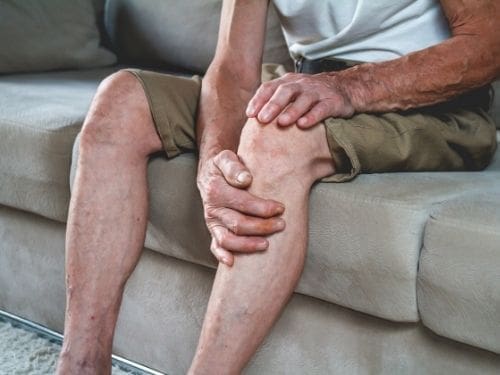 Riconoscere correttamente la natura di una patologia è fondamentale per curarla: scopri quali sono le principali differenze tra artrite e artrosi! Persona anziana si tiene il ginocchio a causa di un dolore
