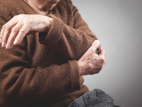 Scopri quali sono i sintomi più comuni causati dall'artrosi! Persona anziana si tiene il gomito a causa di un dolore