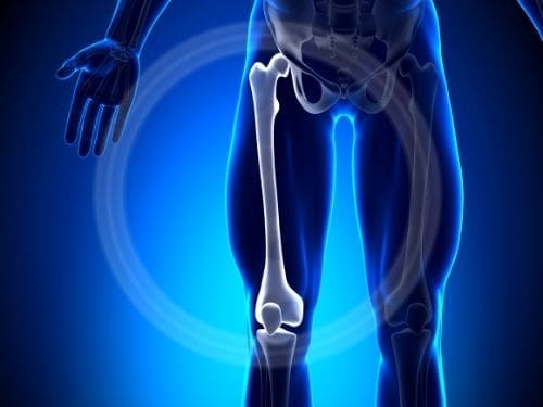 Il femore è l'osso più lungo del corpo umano: scopri le sue caratteristiche! Anatomia femore