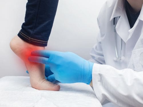 Scopri quali sono i sintomi principali della tendinite al piede! Medico tocca il piede di un paziente mentre lo visita
